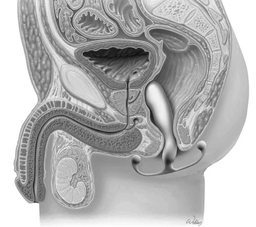 Aneros: la revolución del placer prostático que redefine la masculinidad — ahora en Chile con Dominame.cl